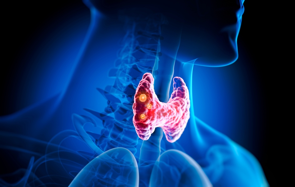 A Gut-First, Anti-Inflammatory Way to Support Thyroid Health