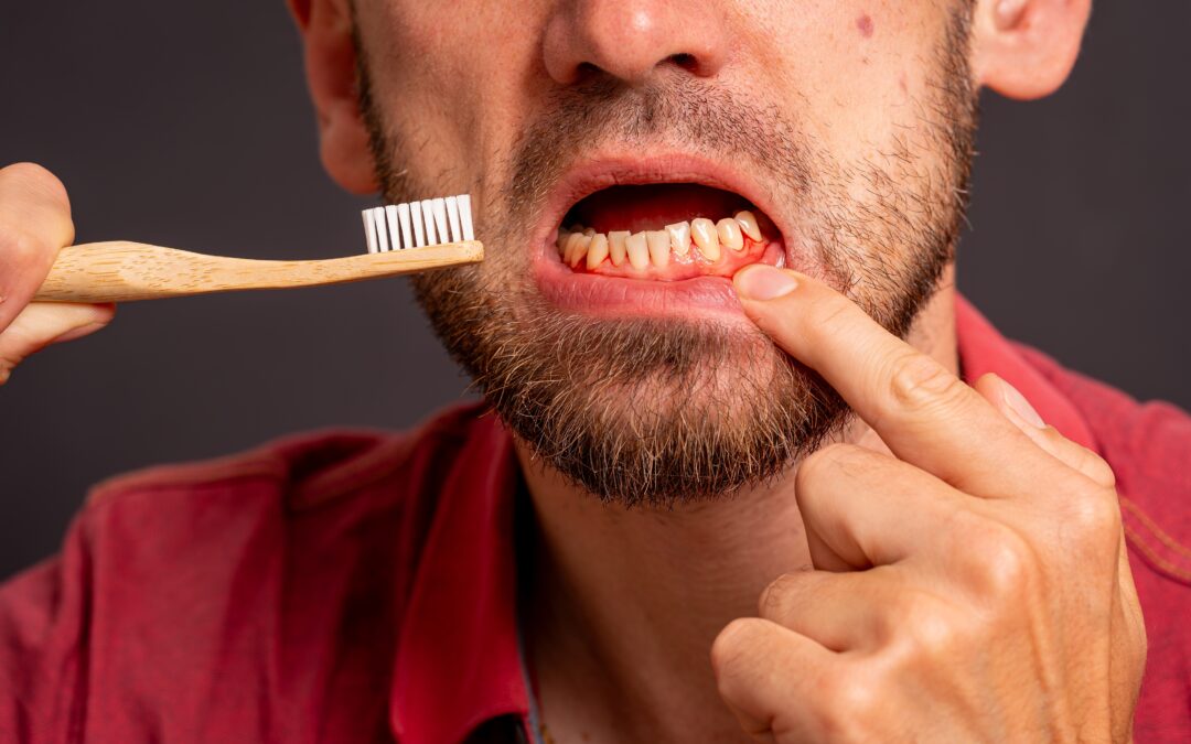 Gum Disease and Gut Health: The Hidden Connection